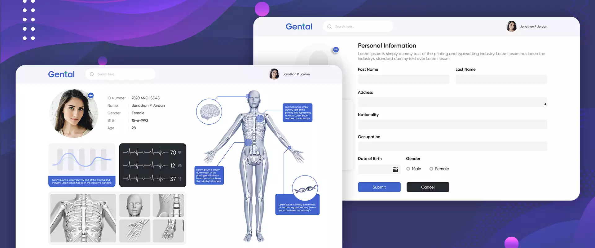 gental-2